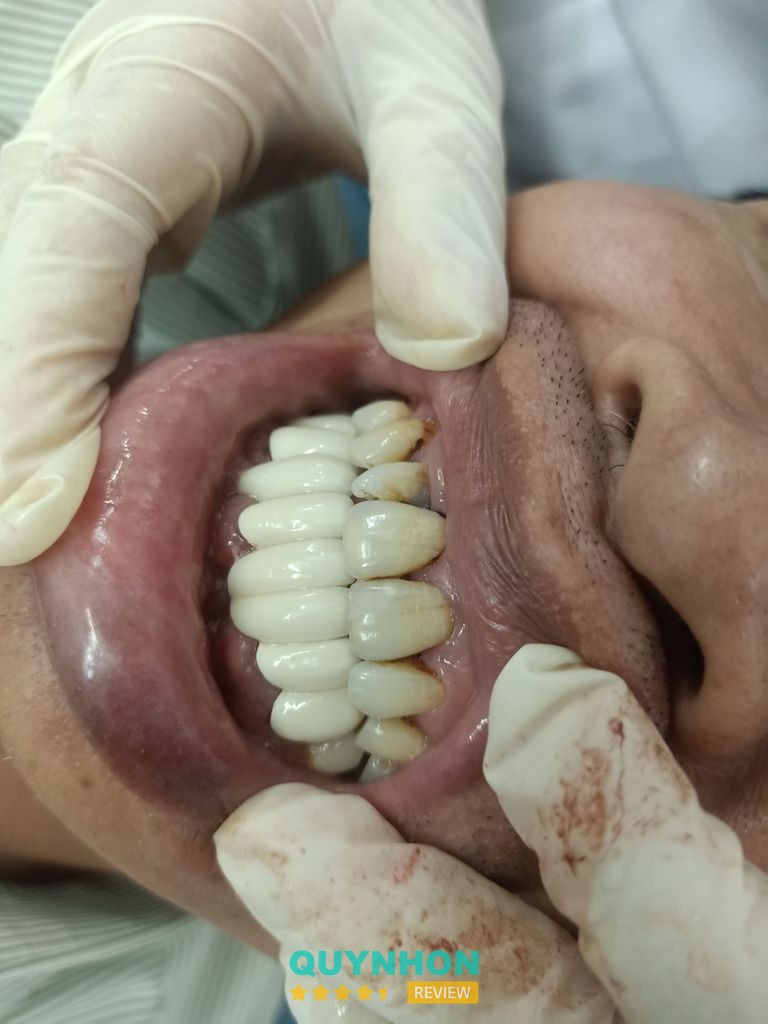 Hình ảnh cơ sở Nha Khoa thẩm mỹ Nguyễn Xuân Tấn