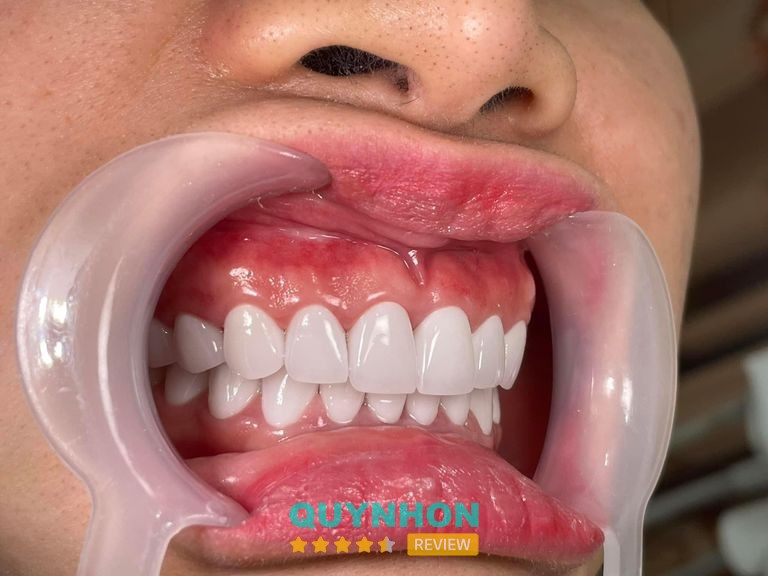 Nha Khoa Quốc Tế Sài Gòn Bồng Sơn – hình ảnh 2