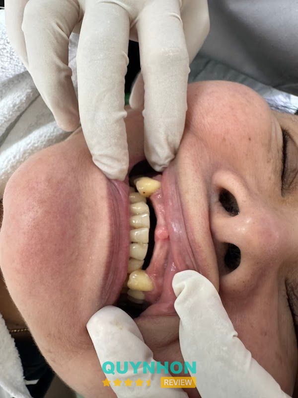 Nha khoa nhà – hình ảnh 2