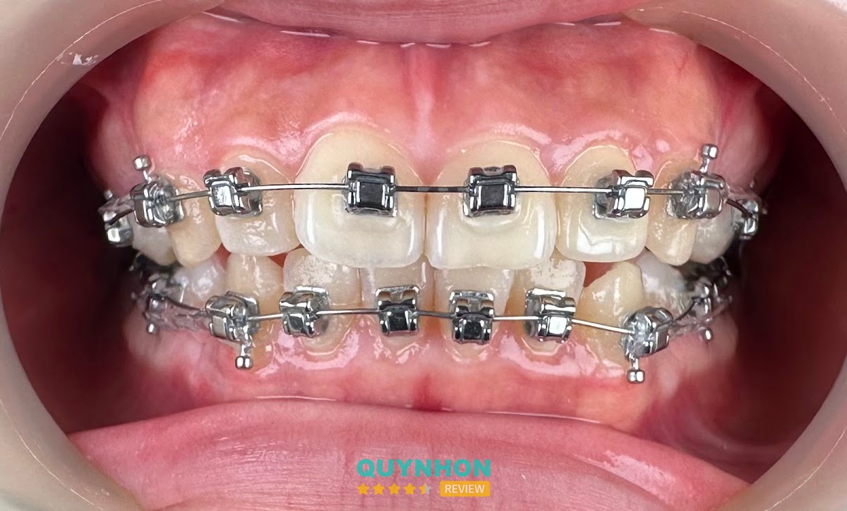 Nha khoa hiện đại – hình ảnh 3