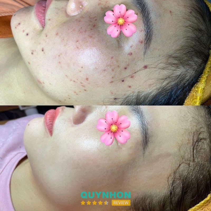 Quyên Spa hình ảnh 2